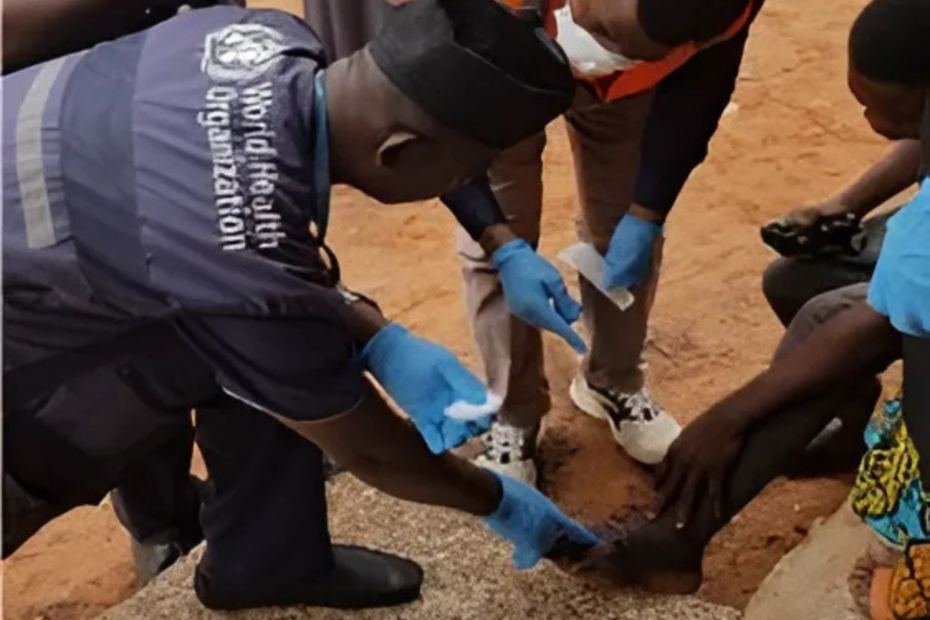  WHO staff, the local health workers collect sample (swap) from the wound for laboratory testing