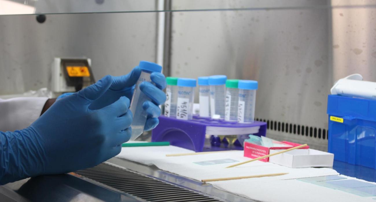 Strengthening laboratory capacity revolutionizes TB treatment in Congo