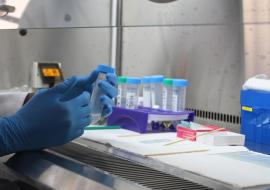 Le renforcement des capacités de laboratoire révolutionne le traitement de la tuberculose au Congo